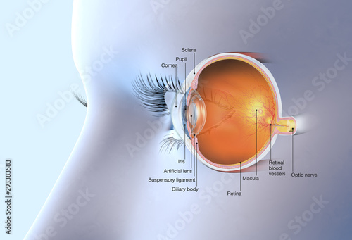 Human eye with artificial lens, medically 3D illustration photo