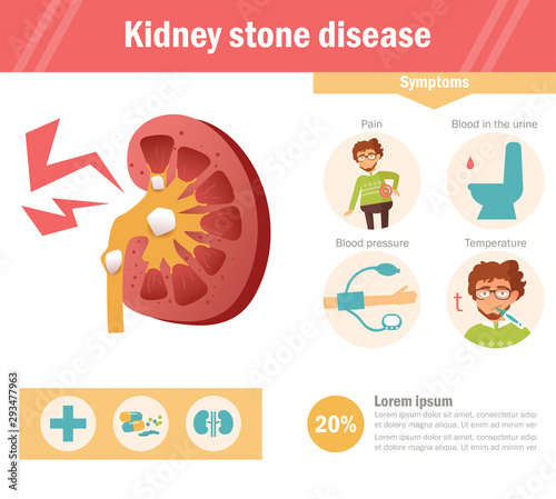 Kidney stone disease Vector. Cartoon. Isolated art on white background. Flat