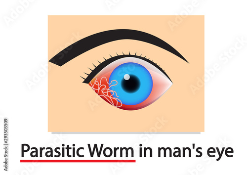 Closeup Parasitic Worms in human's eye, vector art