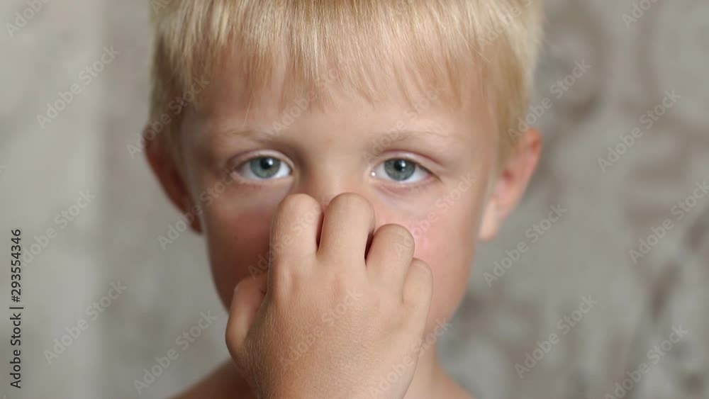 Close-up of a small child scratching his sunburned nose. Portrait of a little boy with a sunburn on his face. Red inflamed burnt skin of a child. Close-up of a small child scratching his sunburned nose. Portrait of a little boy with a sunburn on his face. Red inflamed burnt skin of a child.