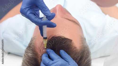 Close-up shot of hair restoration prp injections photo