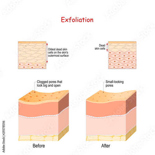 Cross-section of skin layers before and after Exfoliation
