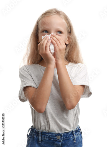 Little girl suffering from allergy on white background