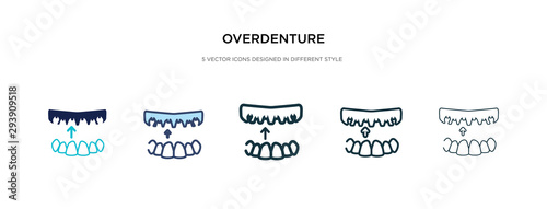 overdenture icon in different style vector illustration. two colored and black overdenture vector icons designed in filled, outline, line and stroke style can be used for web, mobile, ui