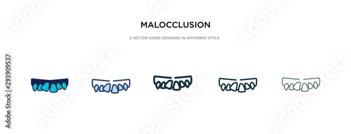 malocclusion icon in different style vector illustration. two colored and black malocclusion vector icons designed in filled, outline, line and stroke style can be used for web, mobile, ui