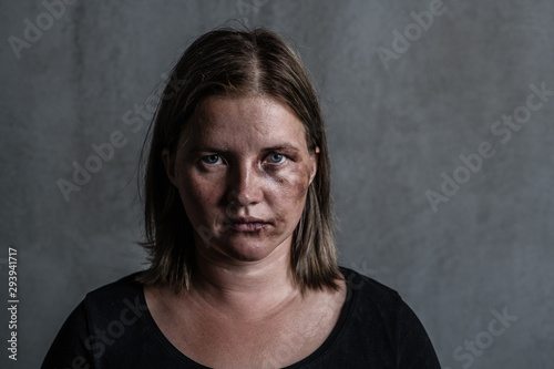 Portrait of the woman victim of domestic violence and abuse photo