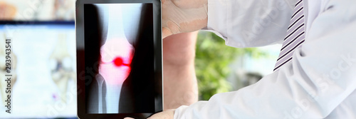 Male physician hands holding tablet computer showing xray shot with paintful area closeup photo