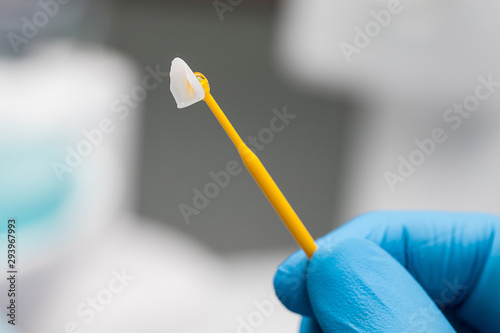 closeup ceramic veneer on a stick in a dentist hand in a blue glove.