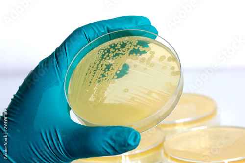 Yellow bacteria on a petri dish in the hand of a scientist on the laboratory background