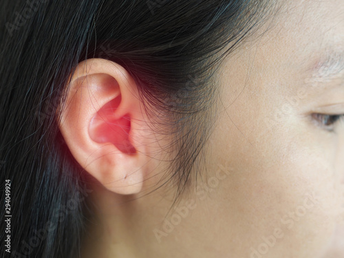 ruptured eardrum,tinnitus and meniere disease and otitis media in asian woman. She use hand touching her ear causes of ear pain on white background use for health care concept. photo
