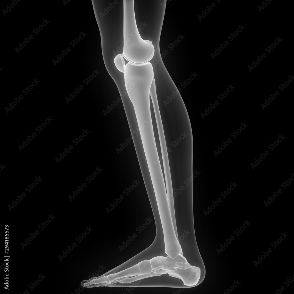 Tibia And Fibula X Ray