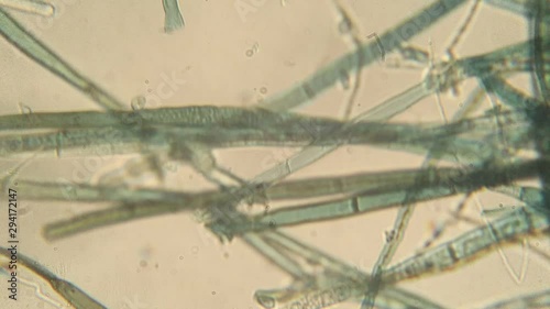 Botrytis cinerea hyphae seen at high magnification under an optical microscope