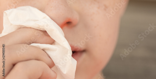 Close up of a child's red stuffy nose photo