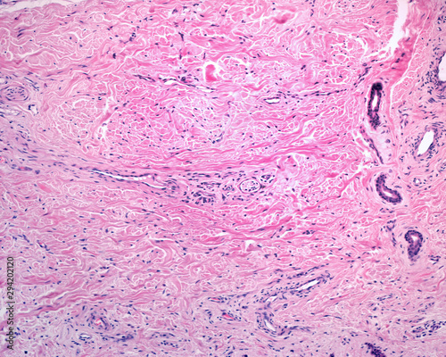 Reticular dermis. Human skin photo