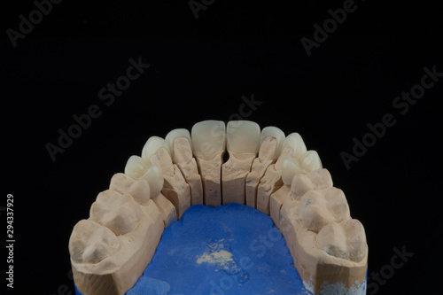 mock dental implants