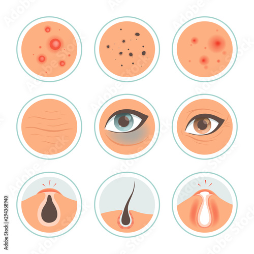 Skin problems. Dark circles woman infection spot washing skin oily face ages pore cleanse vector medical icon. Problem skin dermatology, treatment and care wrinkle illustration