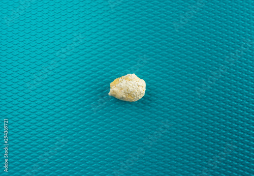 Sialolithiasis salivary duct stone on a blue background with copy space