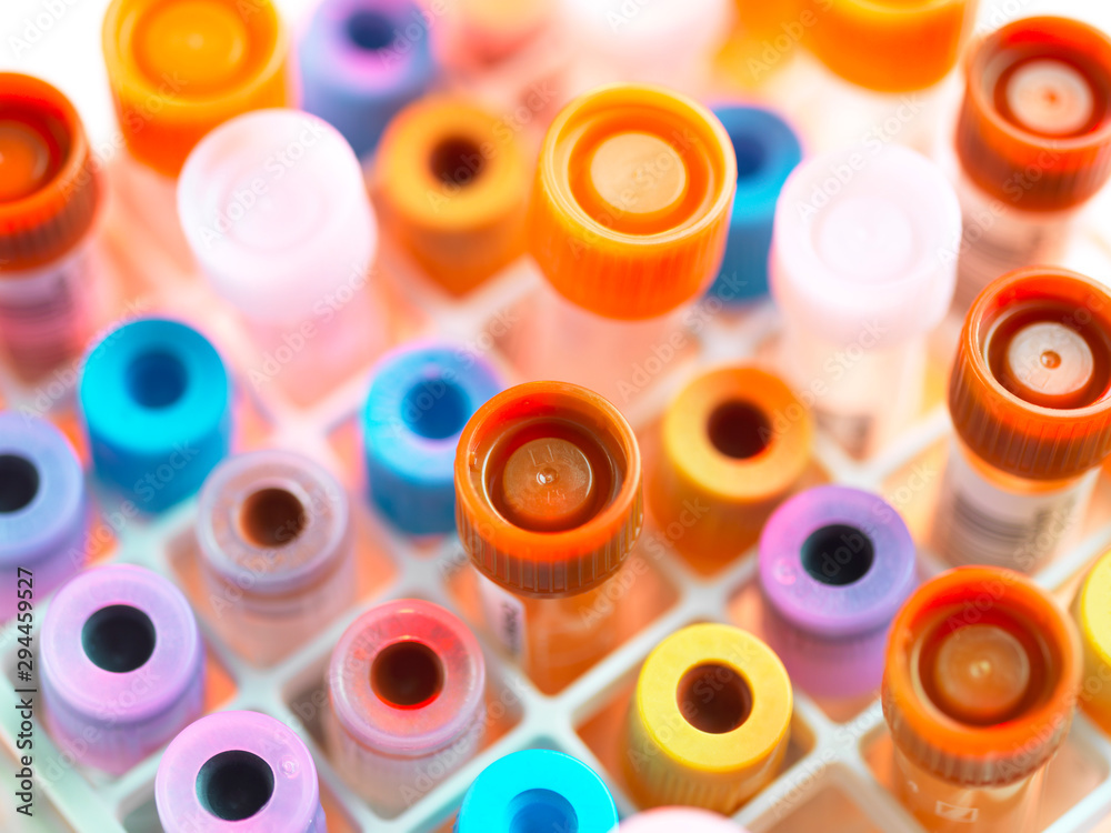 Samples in a tray in a laboratory Samples in a tray in a laboratory