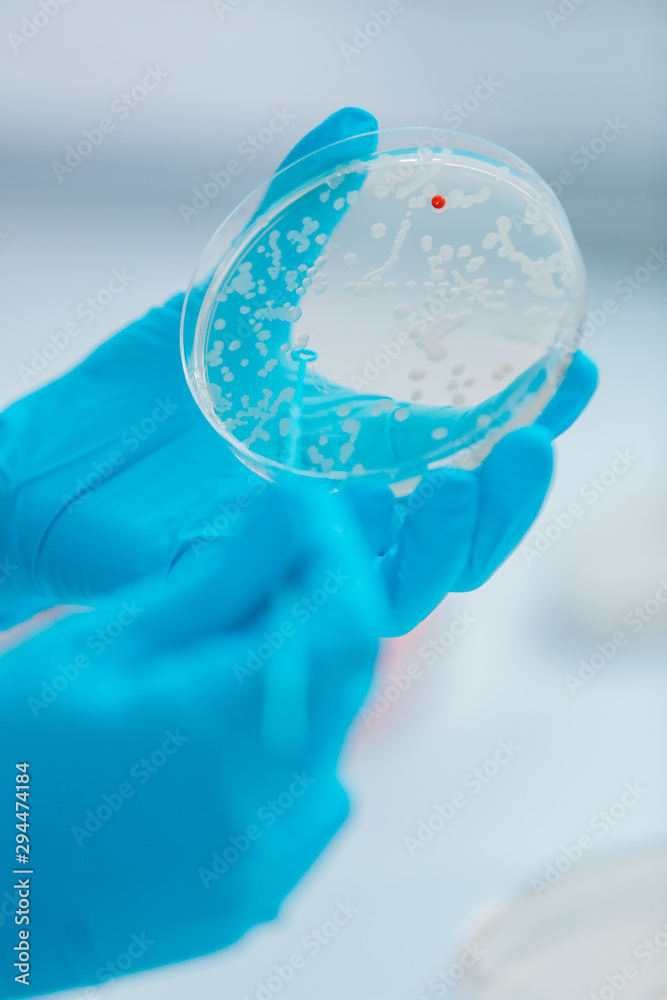 Scientist Examining Bacterial Culture Plate In A Microbiology Research   1000 F 294474184 XMvvxVtwjaNjMzKIpCZyxnoSB5NpuPxh 