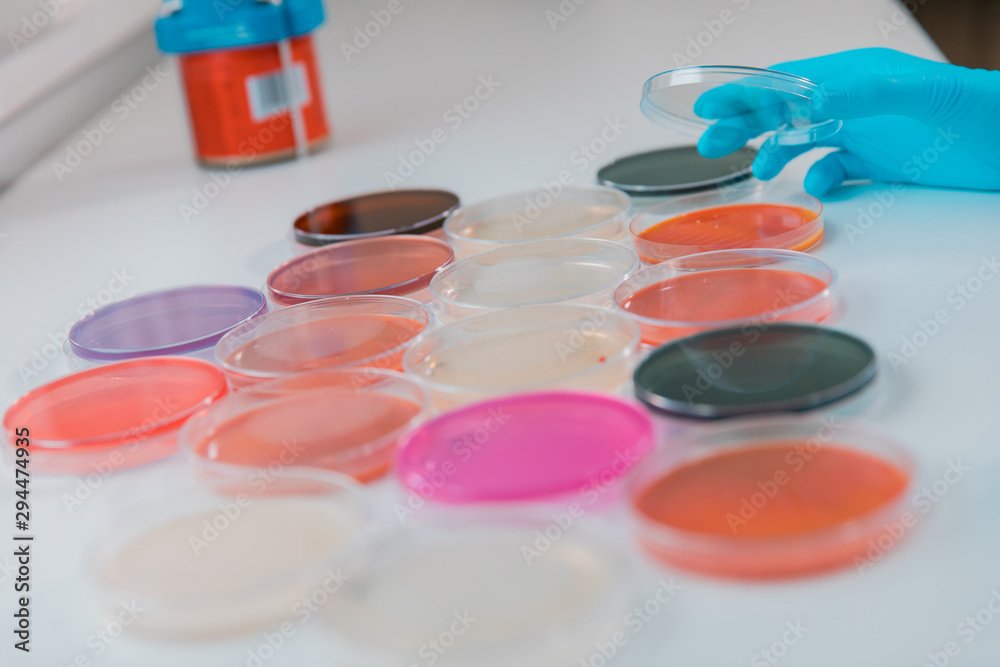 Top view of a Woman scientist holding molds in petri dish with mea malt extract agar. Medical tests in laboratory experiment for checking fungus of environment. Top view of a Woman scientist holding molds in petri dish with mea malt extract agar. Medical tests in laboratory experiment for checking fungus of environment.