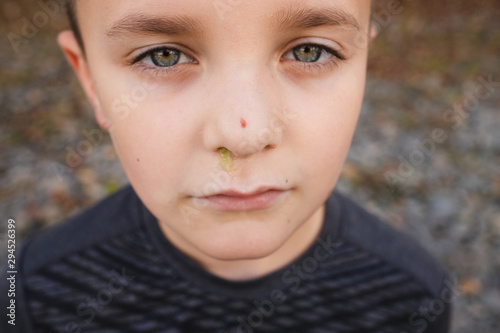 Foto boy with boogers yellow green