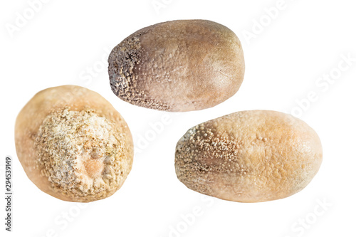 Larger stone size of 4 cm from the gallbladder, removed after surgery cholecystectomy, gallstone disease. Isolated on white background. Top view, straight, side view. photo