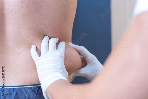 Tratamiento de eliminación de grasa