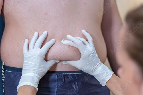 Tratamiento de eliminación de grasa