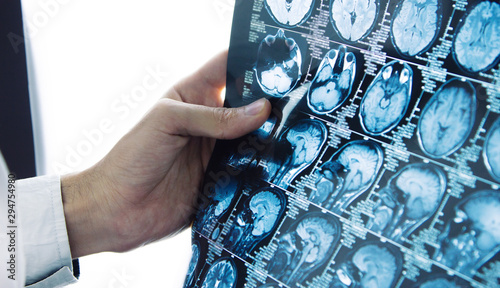 Fotografie Doctor is checking x- ray computed tomography