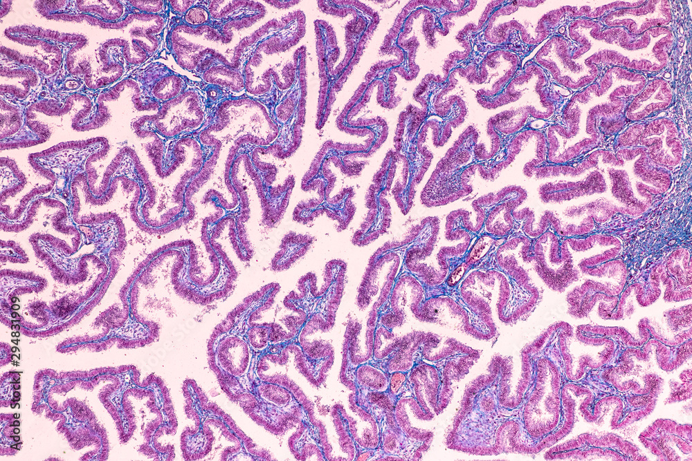 Education of Uterine tube under the microscope in Lab. Education of Uterine tube under the microscope in Lab.