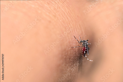 Mosquitoes bite and feeding blood on wrinkle skin. Dengue is a viral infection that spreads from mosquitoes to people. the most common symptoms are high fever, headache,body aches,  nausea and rash. photo