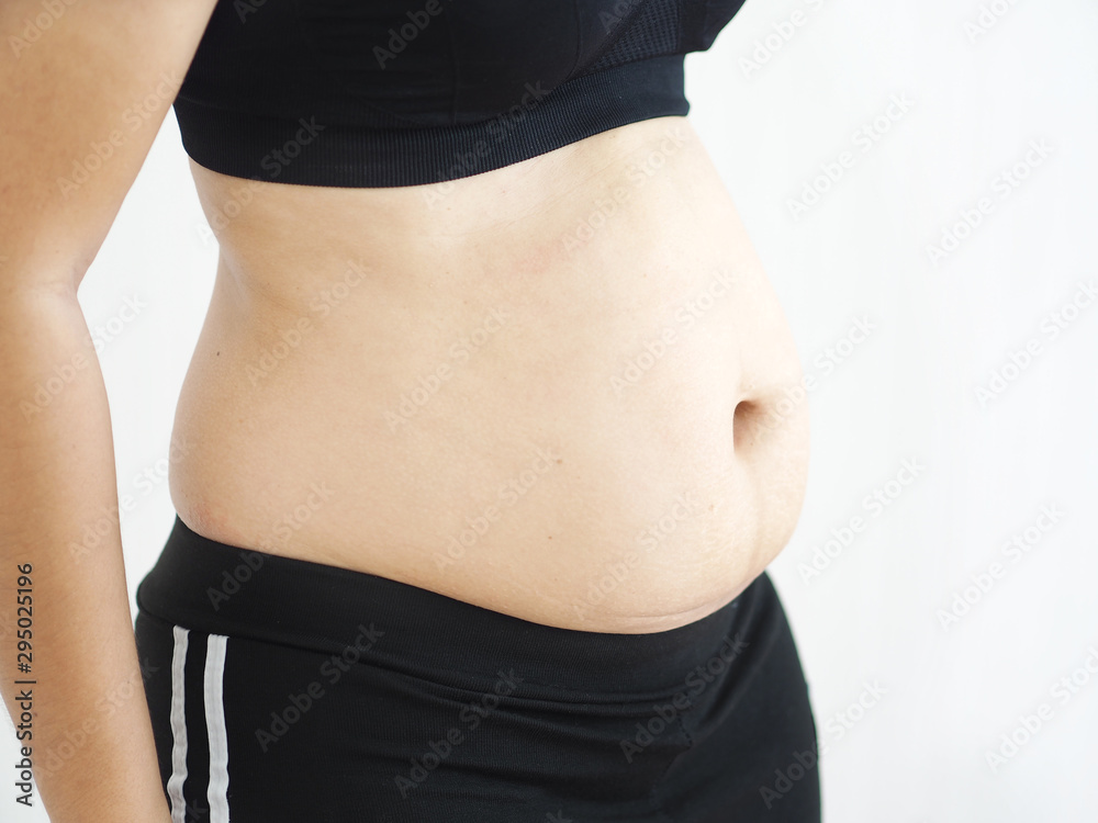 Φωτογραφία cellulite and belly fat in woman on her belly and waist cause of fatty from weig