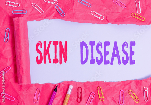 Text sign showing Skin Disease. Business photo showcasing any of the diseases or disorders that affect the huanalysis skin photo