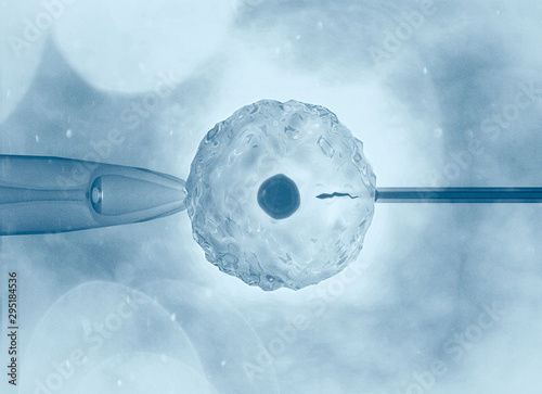 Artificial or assisted fertilization is the process by which the union of gametes is artificially carried out, by observation under a microscope, 3d rendering