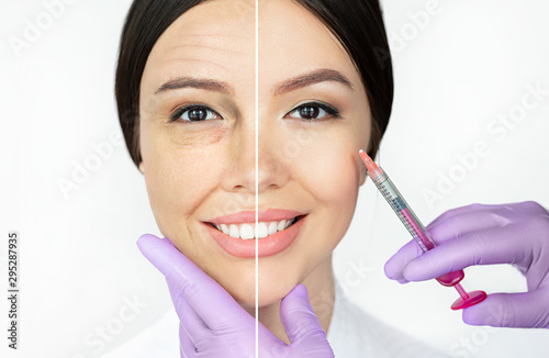 Comparison woman s face with wrinkle and smooth young face after beauty injections. Aged facial skin before and young lifting skin after procedure