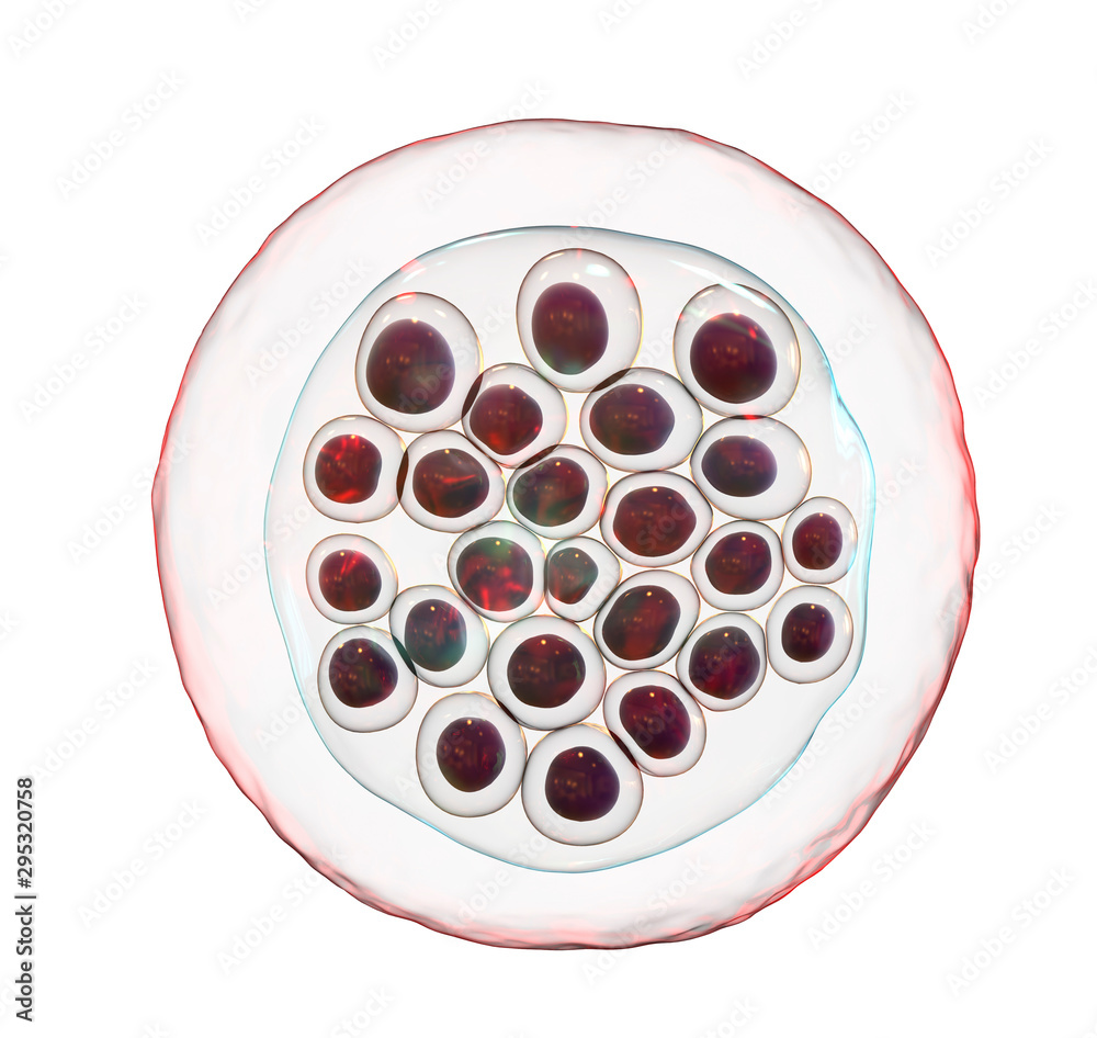 The malaria-infected red blood cells. 3D illustration showing malaria parasite Plasmodium falciparum in schizont stage inside red blood cells, the causative agent of tropical malaria The malaria-infected red blood cells. 3D illustration showing malaria parasite Plasmodium falciparum in schizont stage inside red blood cells, the causative agent of tropical malaria
