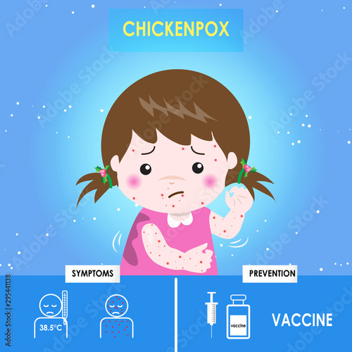 Infographics of chickenpox. Kid Girl with Chickenpox Scratching her Itchy Skin, Health care cartoon character. Prevention and symptom of disease. Cause of infection,diagnostics. Vector illustration