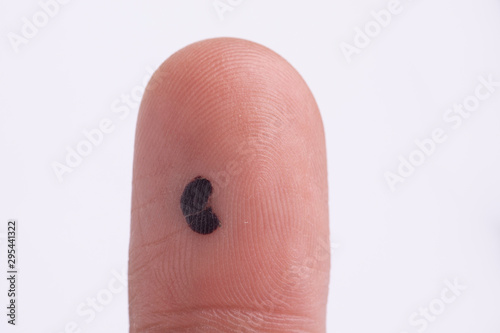Pigmentation on fingertip skin close up