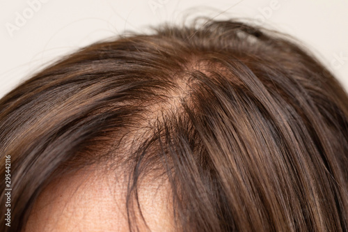 Female hair parting close up
