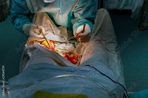 Surgeons team working on leg of patient in operating room.