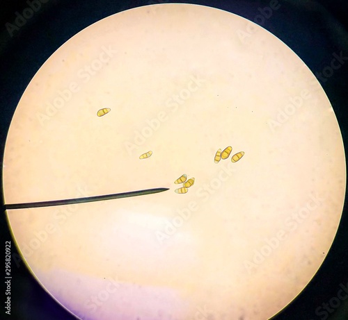 conidia of Curvularia spp. in 40x microscope , Growth on Sabouraud Dextrose Agar  photo