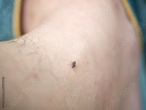 Leg mosquito bites,Animal suck blood in forest,Blister on skin,Man is Asian