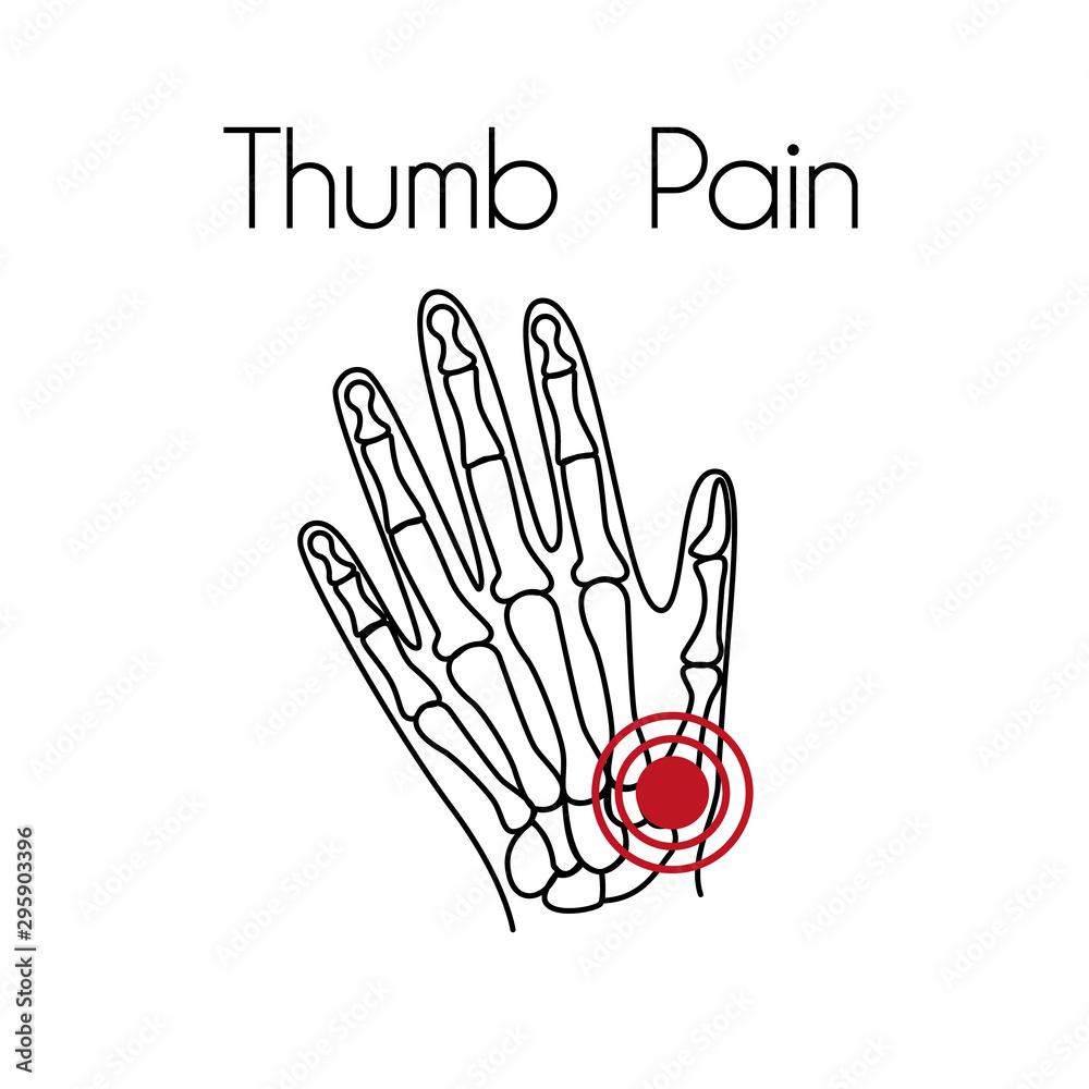 Fototapeta premium Vector Thumb Pain Linear Icon