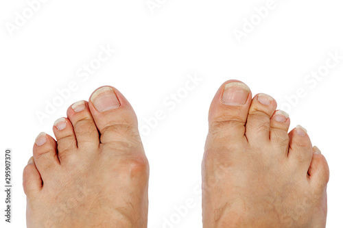 Long toenails. Isolate on a white background.