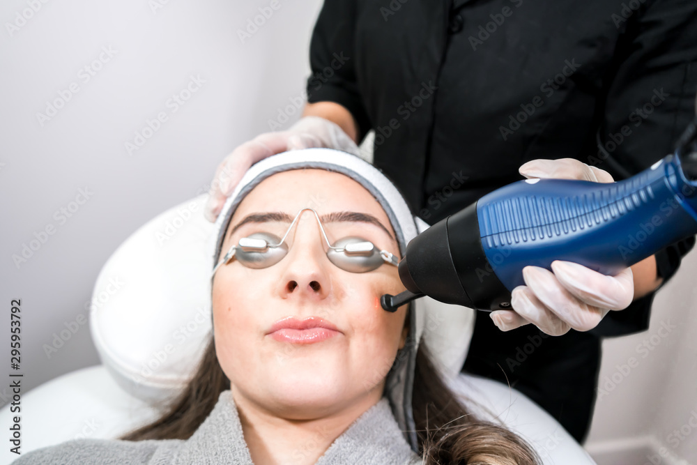 CO2 fractional ablative laser being used for skin rejuvenation (skin  resurfacing) as a medical cosmetic procedure in a beauty laser clinic.  Female patient wearing goggles, with beauty laser technician Stock Photo