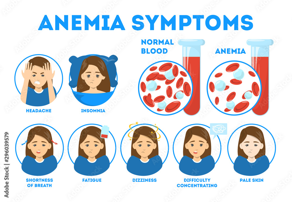 Anemia Symptoms Infographic Blood Disease Idea Of Health Stock Vector