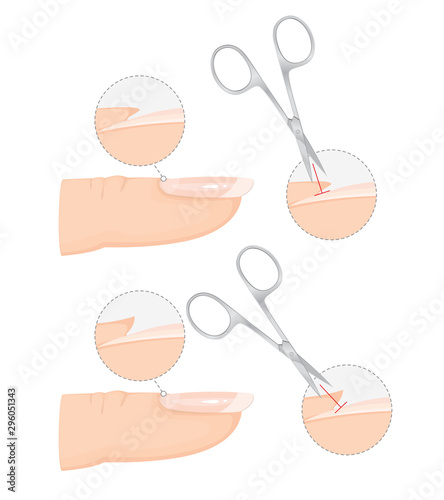 How to Trim Cuticles Professionally with Scissors. Professional Manicure Guide. Vector illustration