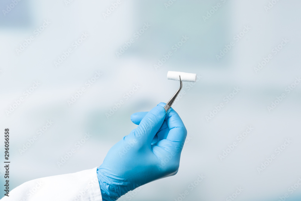 dentist's hand shows a cotton roll in tweezers dentist's hand shows a cotton roll in tweezers