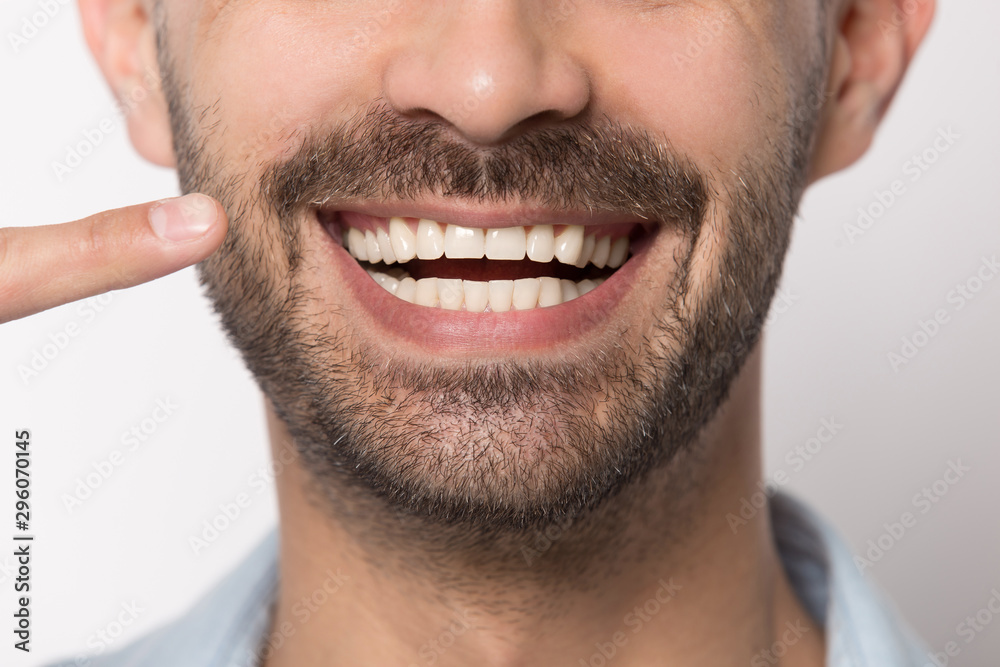 Close up of smiling man showing white healthy teeth Close up of smiling man showing white healthy teeth