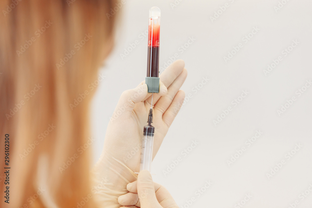 Scientist hand holding test tube with blood in laboratory on blurred background. Portrait of a beautiful female chemist looking analyzing a blood test tube in a medical cabinet Scientist hand holding test tube with blood in laboratory on blurred background. Portrait of a beautiful female chemist looking analyzing a blood test tube in a medical cabinet